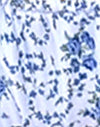 Blauwe Bloemenketting